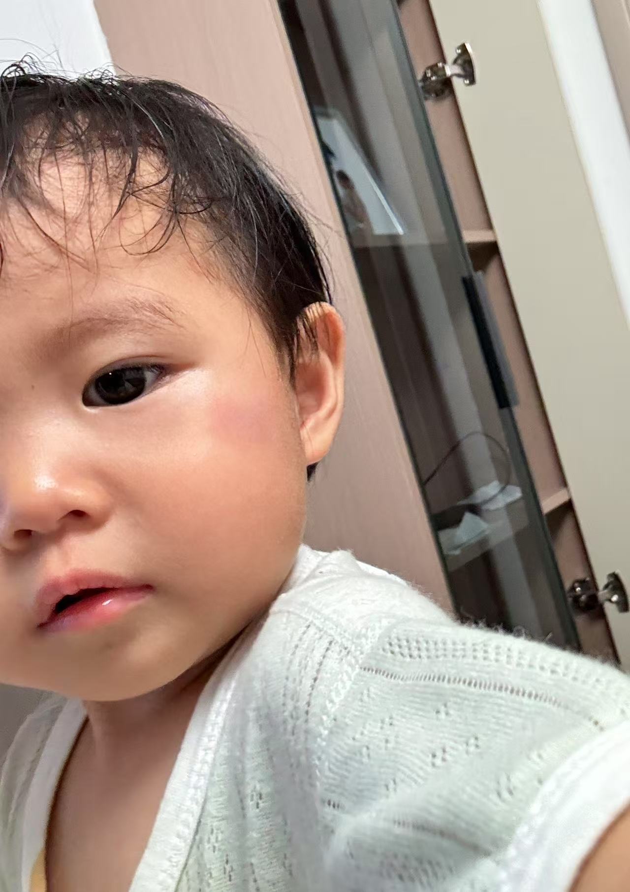 小脸撞乌青了，但很坚强
